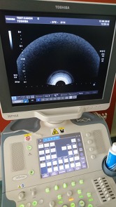 Echographe occasion Toshiba