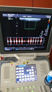 Echographe occasion Toshiba