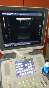 Echographe occasion Toshiba