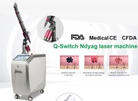 Q-Switched ND yag machine pour relèvement des pigmentations