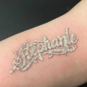 Q-switched ND yag portable laser machine