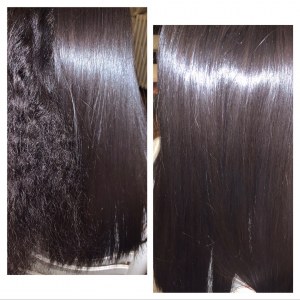 Lissage brésilien au botox