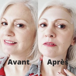 Patchs anti-âge en silicone médical n'utilisant aucun principe actif